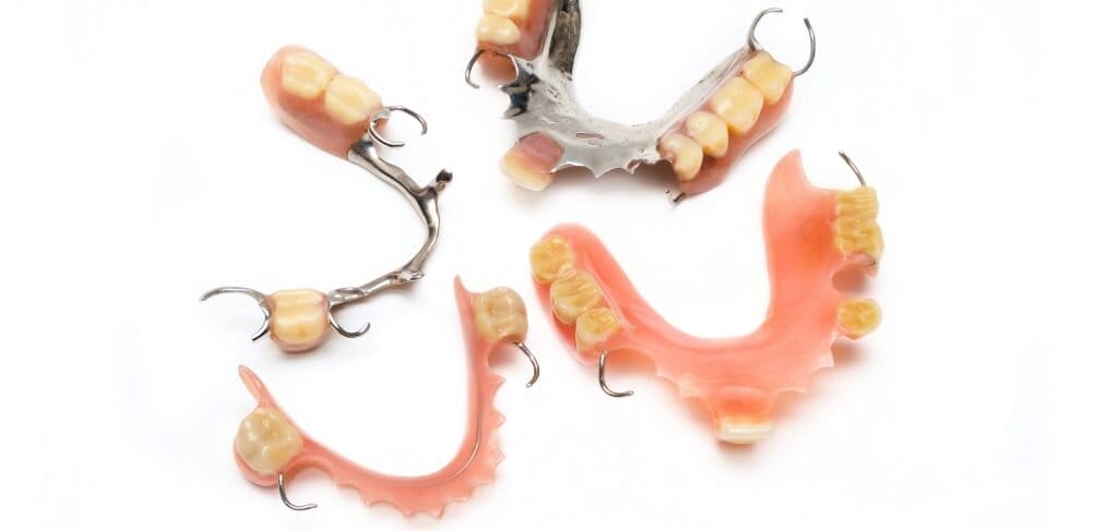 Partial+denture